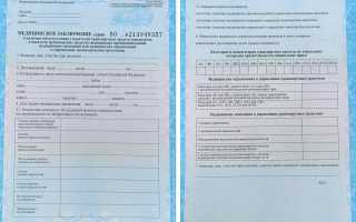 Что скрывает список медицинских противопоказаний для получения водительских прав